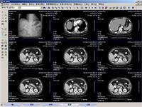 供应DR、CT、MRI等Dicom数字影像工作站