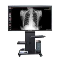 飞利浦Allura Xper FD 20、Allura Xper FD2010平板血管造影机手术监测**MOZO58寸显示器