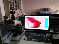 真菌镜检查报告系统软件｜奥林巴斯显微镜CX31系统