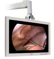 进口24寸医疗腹腔镜监视器FS-P2404D 中国总代理