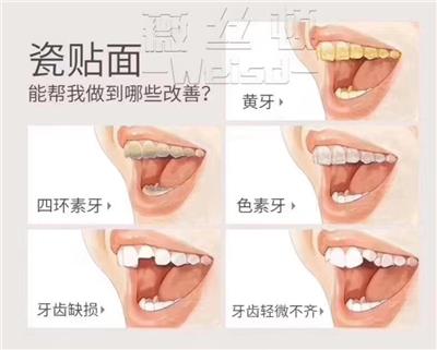周口美牙培训 贴心服务 郑州牙美康生物科技供应