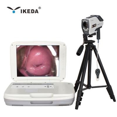 YKD-3004 数码电子私密镜 便携一体化妇科检查设备 折叠式私密检查设备 便携妇科体检设备