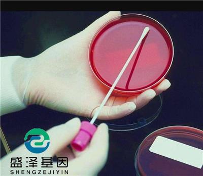 广东中山血型亲子鉴定方法