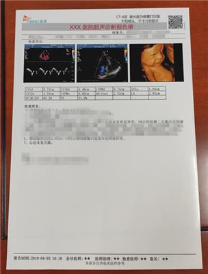 广州万玛医疗科技有限公司现货提供梅清超声胶片-小白片