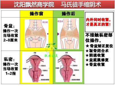 中医正骨培训班手法怎么样？