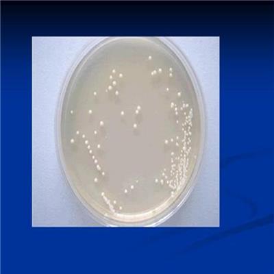 宜兴杀菌剂抗藻性能检测 保鲜膜抗菌检测