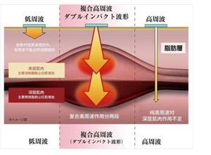 美塑机——让所有人变美、变健康不再是难事