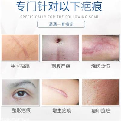 硅凝胶疤痕贴 源头厂家 术后术后修复贴定制贴牌
