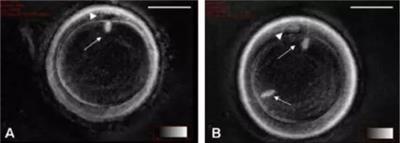 北京纺锤体实时成像纺锤体卵冷冻研究 上海嵩皓科学仪器供应