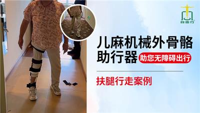 山东便宜的机械外骨骼器材 推荐咨询 自由行供应