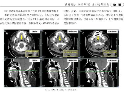 上海中频电刺激睡眠呼吸治疗仪是什么 诚信经营 上海预顺生物科技供应