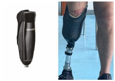 盐城假肢定制 信息推荐 赴健假肢矫形医疗科技供应