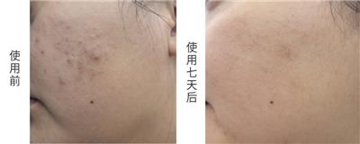 增城区强韧敏感肌虾青素次抛精华液电话多少 推荐咨询 同康国际生物科技供应